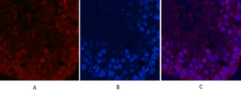 Ki 67 Mouse Monoclonal Antibody