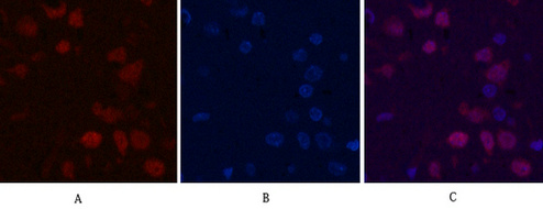 Ki 67 Mouse Monoclonal Antibody