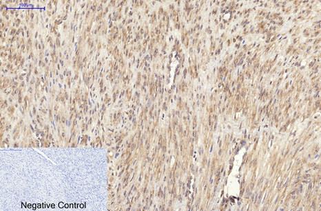 Ki 67 Mouse Monoclonal Antibody