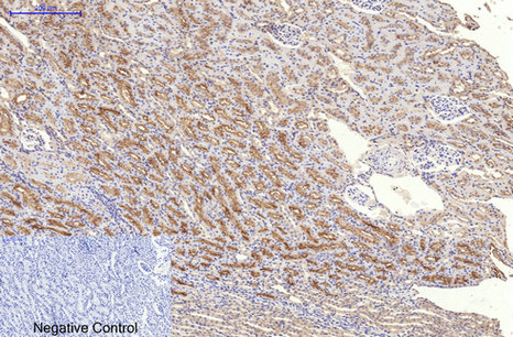 Ki 67 Mouse Monoclonal Antibody