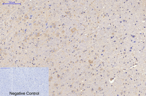 MAP2 Mouse Monoclonal Antibody