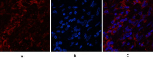 Cytokeratin 6 Mouse Monoclonal Antibody