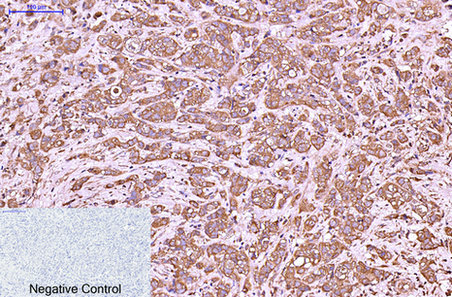 Cytokeratin 6 Mouse Monoclonal Antibody