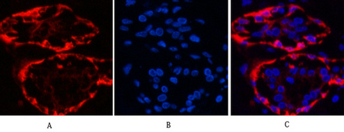CK17 Mouse Monoclonal Antibody