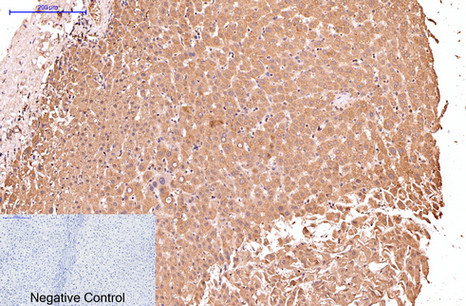 CK17 Mouse Monoclonal Antibody