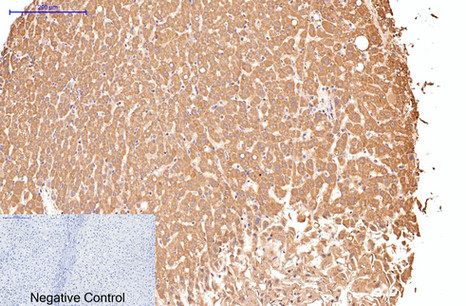 CD16 Mouse Monoclonal Antibody (Q32)