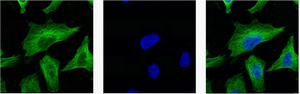 β-tubulin Mouse Monoclonal Antibody