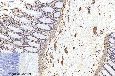 β II tubulin Mouse Monoclonal Antibody (Rodent Preferred)