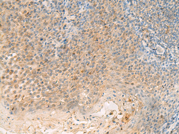 FBXO9 Antibody