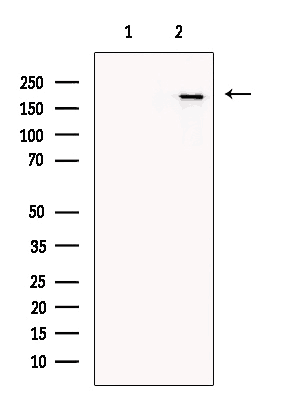 Collagen XIV α1 Antibody 