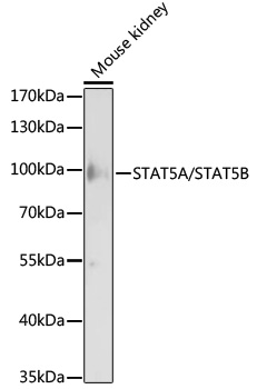 STAT5A/STAT5B Polyclonal Antibody
