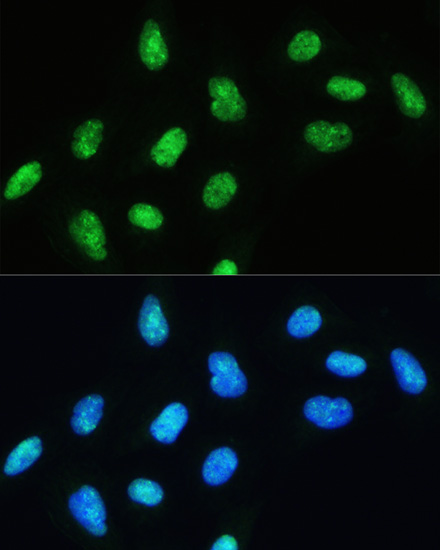 DHX9 Polyclonal Antibody