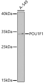 POU1F1 Polyclonal Antibody