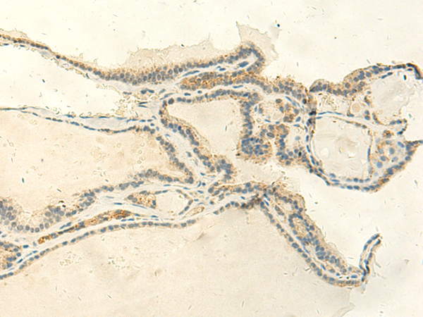 ASB6 Antibody