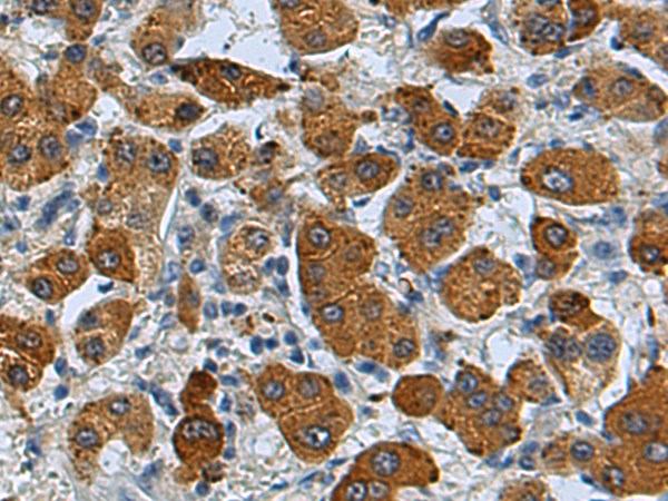 HSD17B13 Antibody