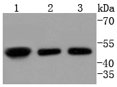 E2F2 Rabbit mAb