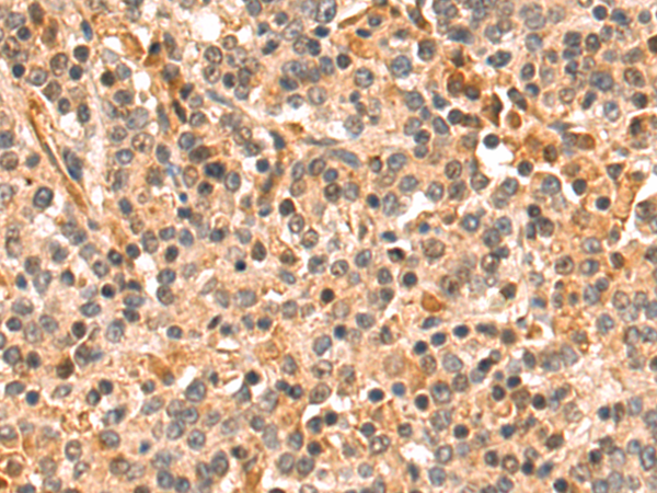 MAP3K11 Antibody