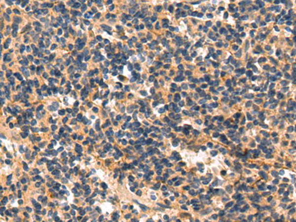 MAP3K11 Antibody