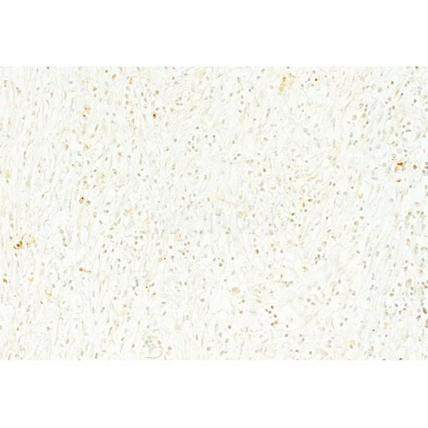 MYCN Antibody