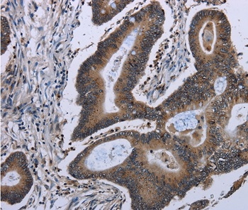 ITGAE Antibody