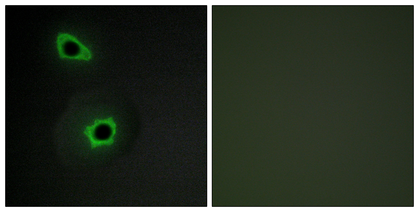 COL7A1 Polyclonal Antibody