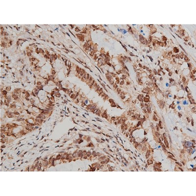 Akt(Phospho-Ser473) Antibody