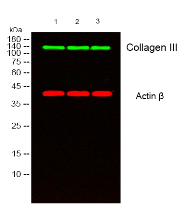 Collagen III (1D4) Mouse mAb