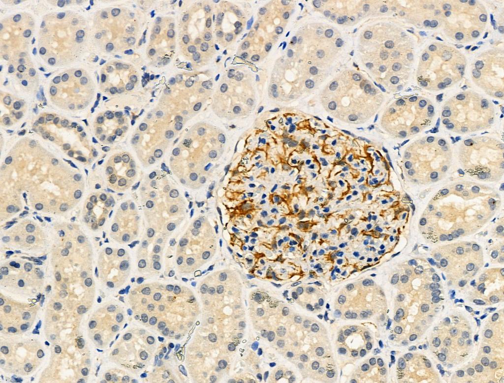 Ras-GRF1 (Phospho-Ser916) Antibody