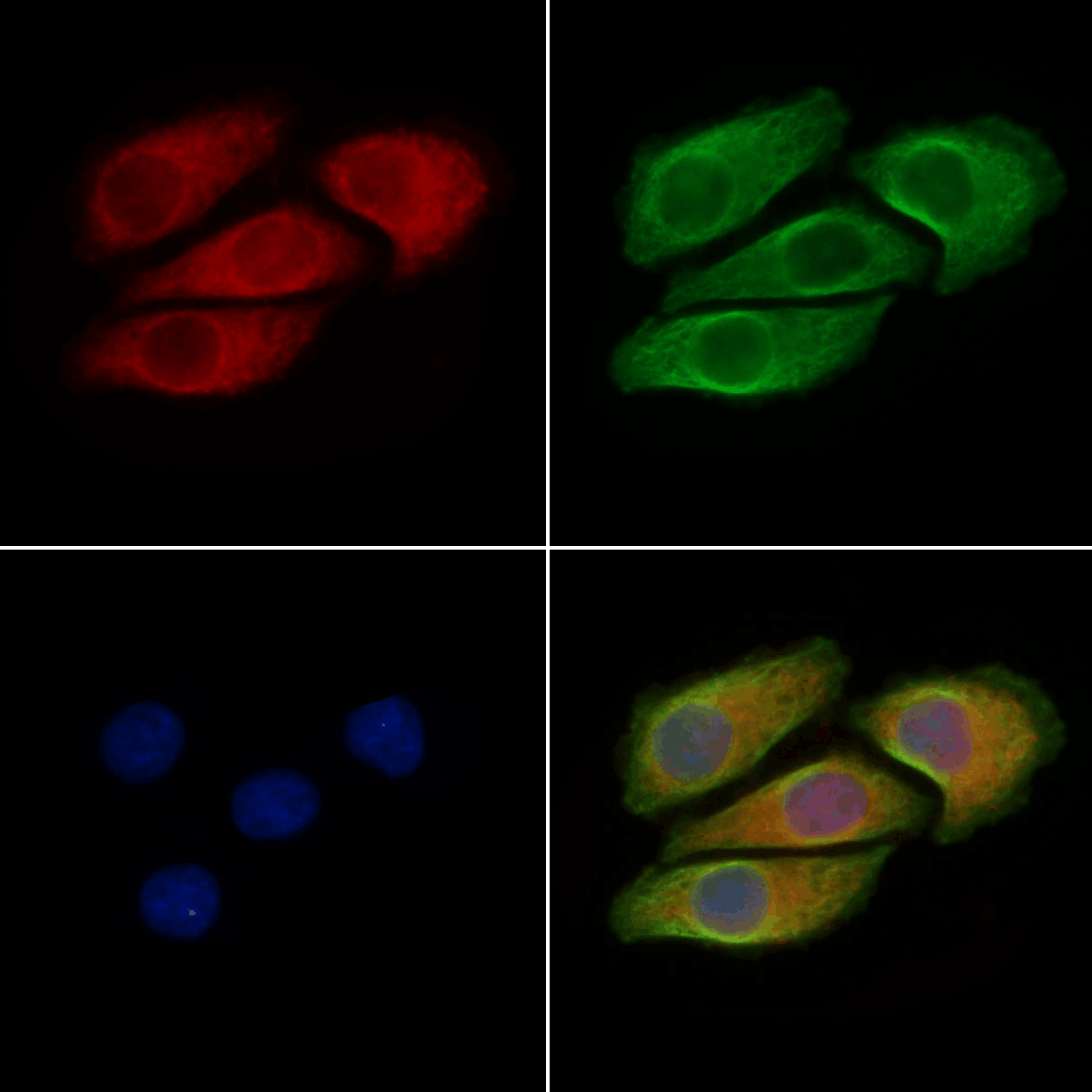 B-RAF (Phospho-Thr599) Antibody