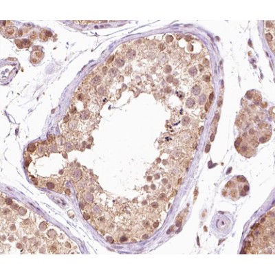 B-RAF (Phospho-Thr599) Antibody