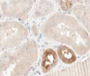 TNAP2 Antibody