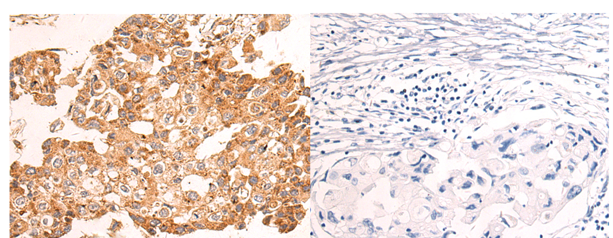 NDUFA2 Antibody