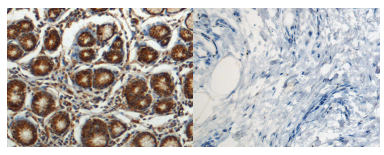 RASAL2 Antibody