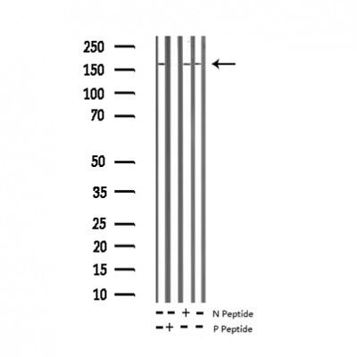 VEGFR2(Phospho-Tyr1214) Antibody