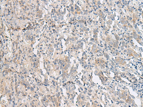 PCSK5 Antibody