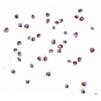 NOD2 Antibody