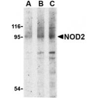 NOD2 Antibody