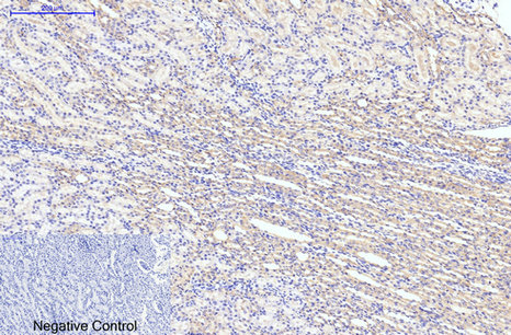 LC3B Antibody