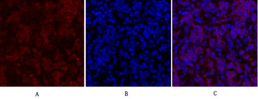 IGF-IR Polyclonal Antibody