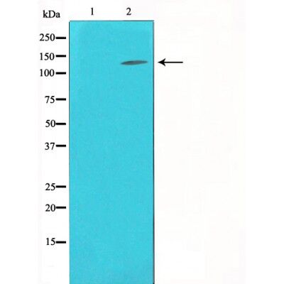 Collagen III Antibody