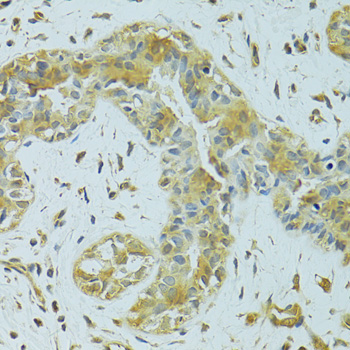 MTCH1 Polyclonal Antibody