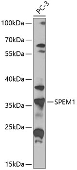 SPEM1 Polyclonal Antibody