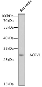 ACRV1 Polyclonal Antibody