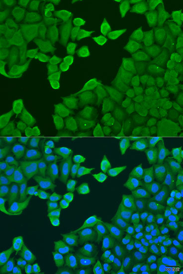 ARF3 Polyclonal Antibody