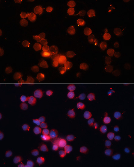 CEACAM8 Rabbit Polyclonal Antibody
