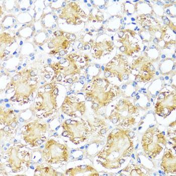 MAS1 Rabbit Polyclonal Antibody