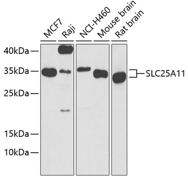 SLC25A11 Rabbit Polyclonal Antibody