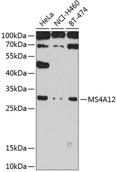 MS4A12 Polyclonal Antibody