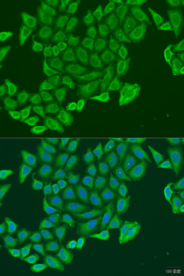 EXOC2 Polyclonal Antibody
