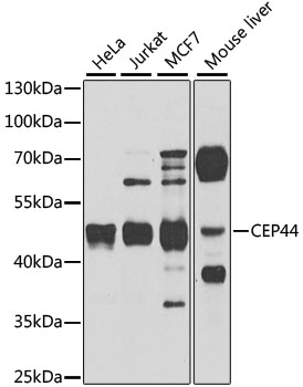 CEP44 Polyclonal Antibody